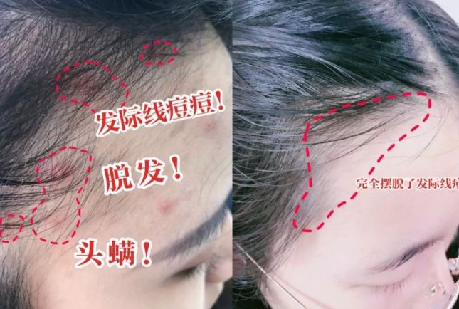 好？10分钟轻松养成女明星「绸缎发」AG真人百家乐洗完头自然风干还是吹干(图11)